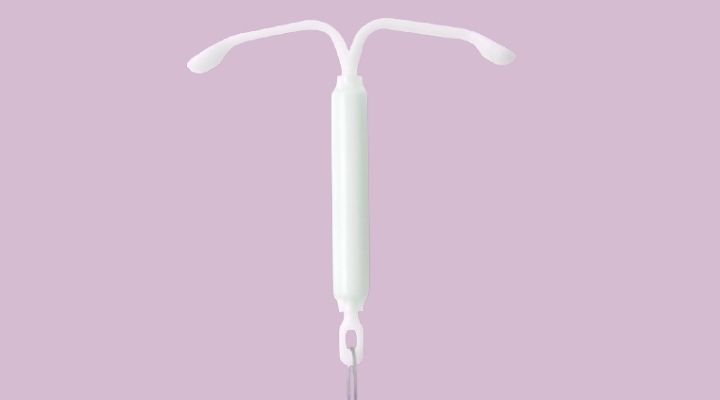 Imagem sobre o DIU Mirena.