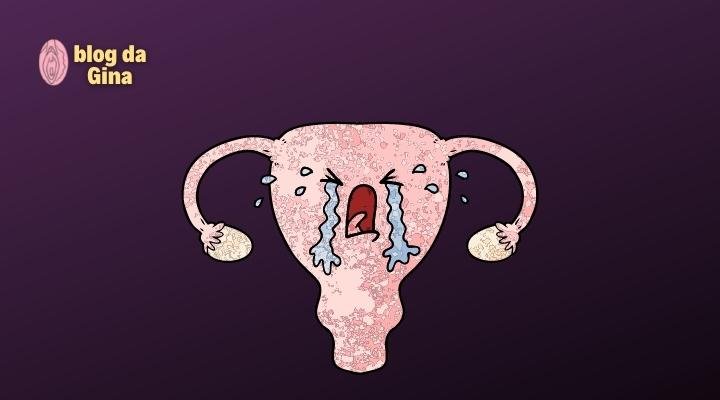 Candidíase Genital – 3 Dicas para Evitar